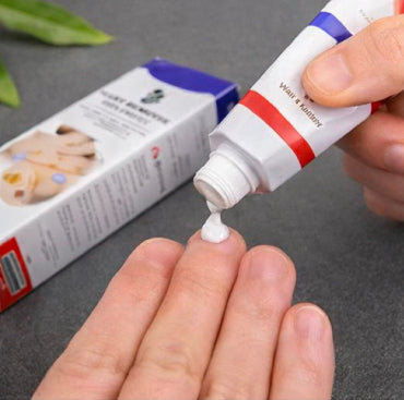 Warts Remover